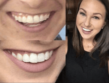 Load image into Gallery viewer, Snow® At-Home Teeth Whitening Kit - 50% Off